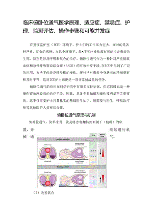 临床俯卧位通气医学原理、适应症、禁忌症、护理、监测评估、操作步骤和可能并发症.docx