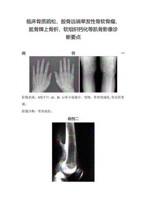 临床骨质疏松、股骨远端单发性骨软骨瘤、肱骨髁上骨折等肌骨影像诊断要点.docx