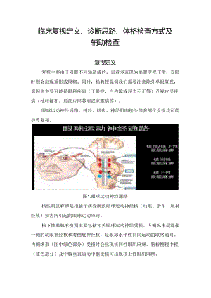 临床复视定义、诊断思路、体格检查方式及辅助检查.docx