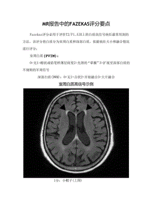 MR报告中的FAZEKAS评分要点.docx