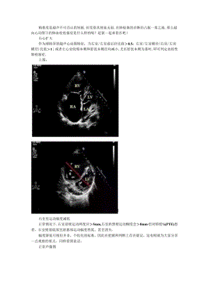 超声心动图九大征象看肺动脉栓塞与超声鉴别诊断要点.docx