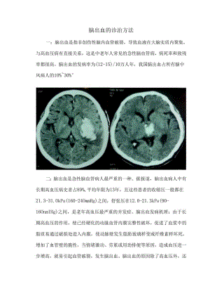 脑出血的诊治方法.docx