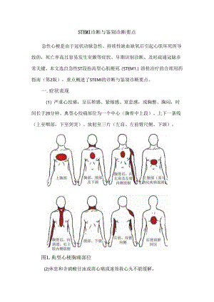STEMI诊断与鉴别诊断要点.docx