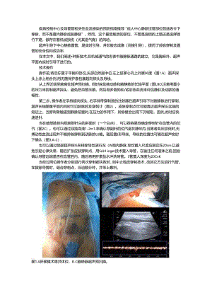 超声引导腋静脉穿刺置管术（超声引导经腋静脉穿刺中心静脉置管临床应用）.docx