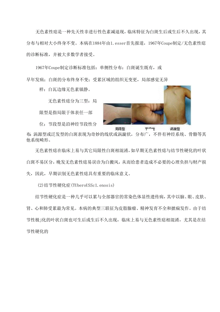 儿童常见色素性皮肤病的诊断与鉴别报告.docx_第2页